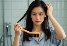 can phentermine cause hair loss